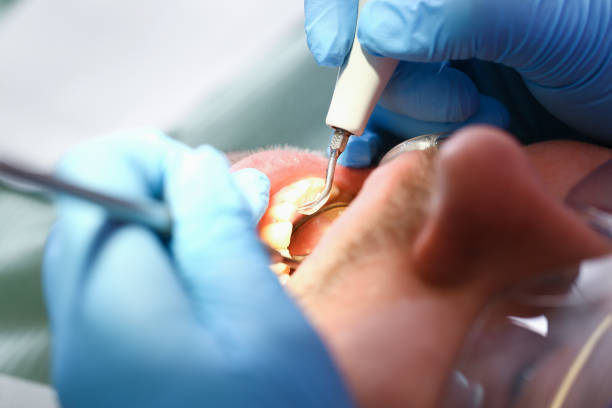 Best Walk-In Emergency Dentist in Renova, MS