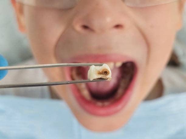 Best Emergency Treatment for Toothache in Renova, MS