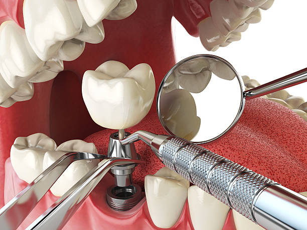 Best After-Hours Emergency Dentist in Renova, MS